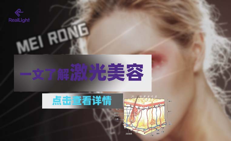 一文了解激光美容